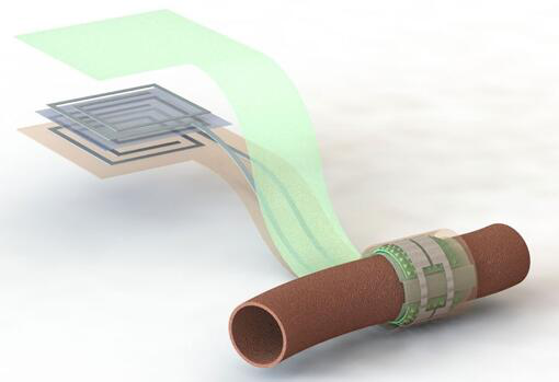 上圖描繪了這款可生物降解的壓力傳感器，它圍繞著一根血管，天線(xiàn)在左側(cè)(分離的層狀結(jié)構(gòu)，展示了天線(xiàn)結(jié)構(gòu)的細(xì)節(jié))